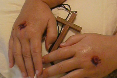 Что такое стигматы?