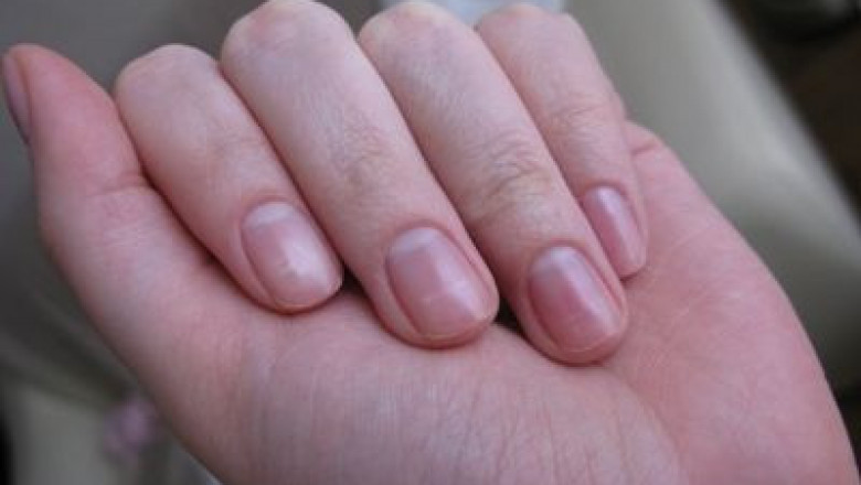 Здоровый цвет ногтей на руках фото