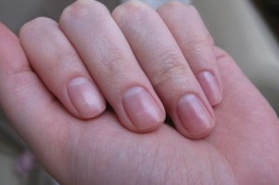 Определение болезней по цвету ногтей