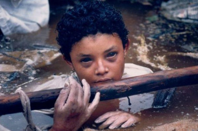 Омара Санчес- ребенок,который умирал перед камерами