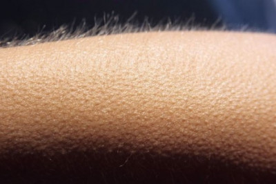 Откуда берутся мурашки?