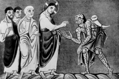 Проказа как болезнь отверженных