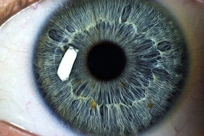 Может ли в течение жизни меняться цвет глаз?