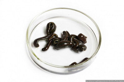 Какие заболевания лечит гирудотерапия?