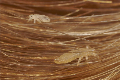 Связано ли появление вшей с несоблюдением гигиены?