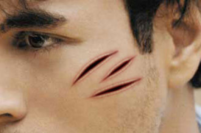 Интересные факты о шрамах