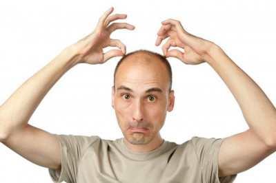  С чем связано облысение?