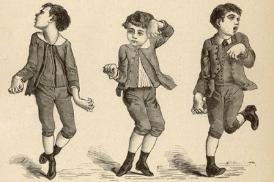 Что такое хорея?