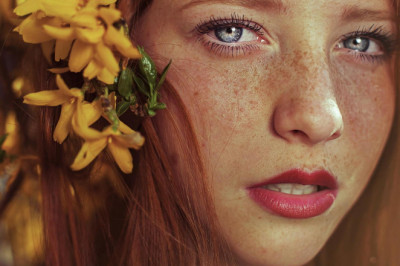 Что такое веснушки и откуда они появляются?