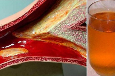 Продукты,влияющие на уровень холестерина в крови