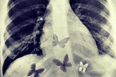 Откуда берутся бабочки в животе?