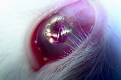  Какие инновации придуманы с контактными линзами?