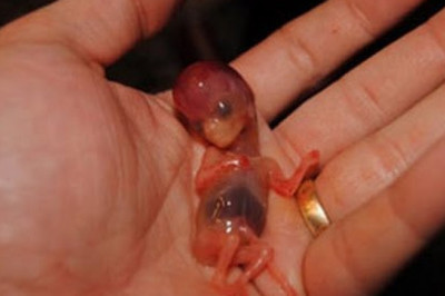 Гомункулы- правда или миф?