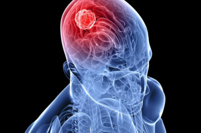 7 печальных фактов о раке