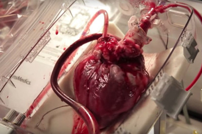 Поразительные сведения о разных сердцах