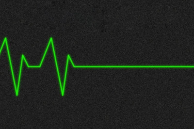 Правда ли, что лишь дефибриллятором можно 