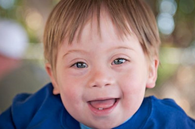 Как частота развития синдрома Дауна связана с возрастом матери?