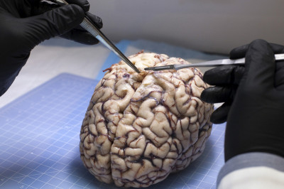 Какого цвета головной мозг человека?
