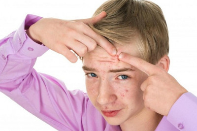 Может ли шоколад вызывать угревую сыпь?