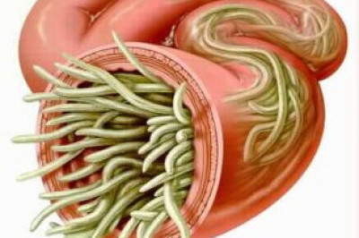 Чем опасен паразитизм в человеческом теле?