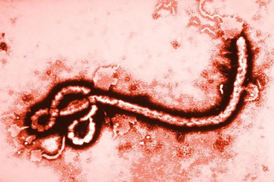 Как ученые смогли создать модель вируса Эбола и чем это может помочь человечеству?