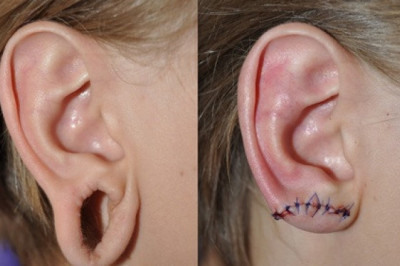 Тоннели в ушах как способ самовыражения