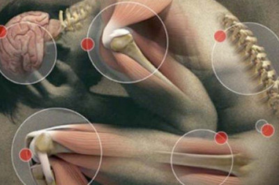 Что такое невралгия?