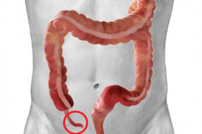 Зачем человеку нужен аппендикс?