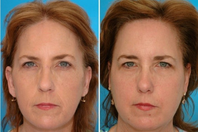 На каких людях лучше видны последствия курения?