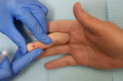 По какой причине кровь для анализов берут из безымянного пальца?