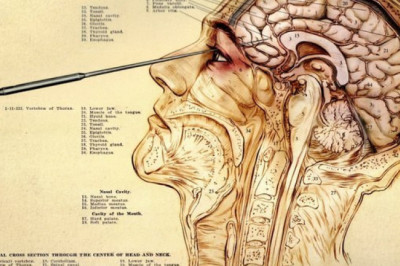 Как лоботомия набирала популярность в лечении психических недугов