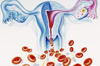 Что такое аменорея и каковы ее причины?