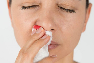 Каковы возможные причины носового кровотечения?