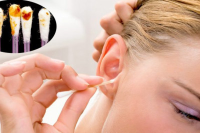 Откуда берется сера в ушах?