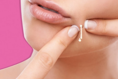 Почему нельзя выдавливать прыщи?