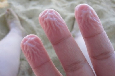 Почему от долгого пребывания в воде кожа морщится?