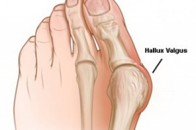 Откуда берутся 